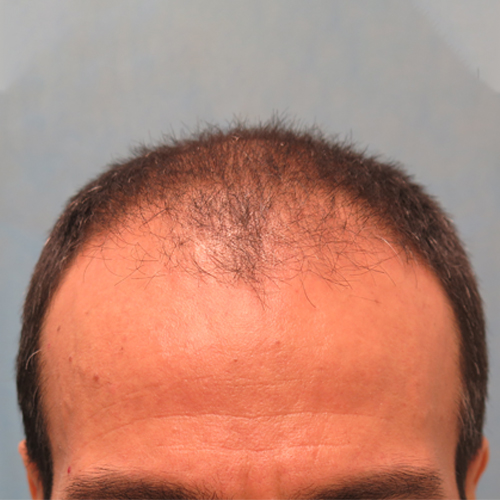 Before