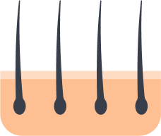 Preparing the follicles