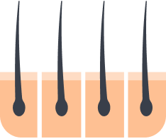 Separating the follicles