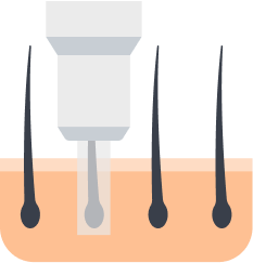 Preparing the hair follicle