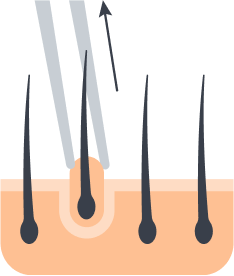 Follicle extraction