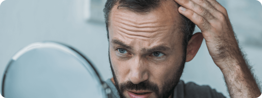 Man checking receding hairline