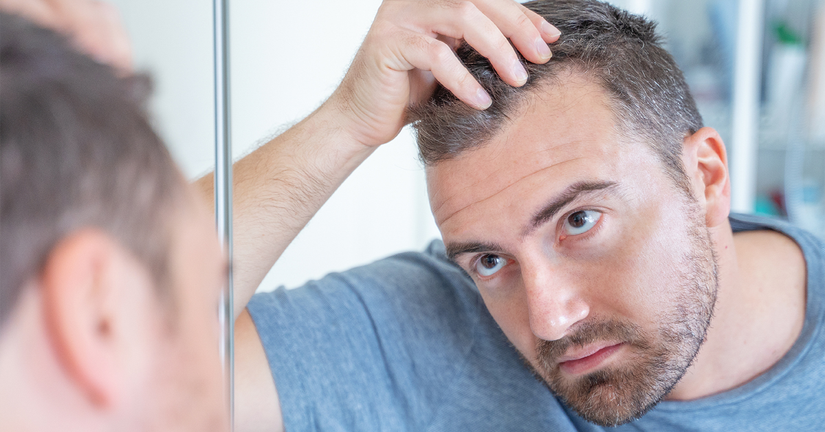 Testosterone’s Effect on Hair Loss