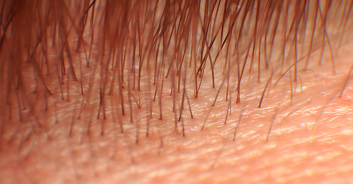 What Are the Stages of Hair Growth?